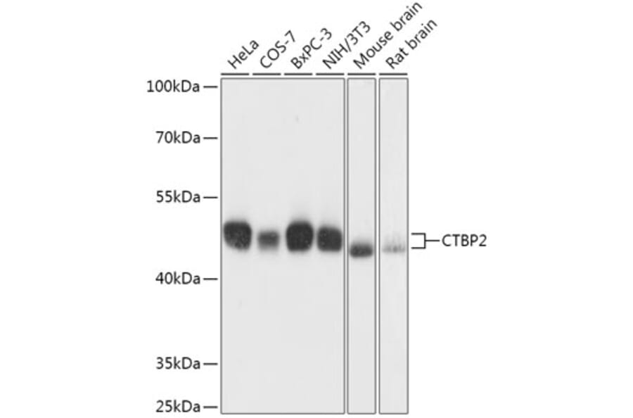 Western Blot - Anti-CTBP2 Antibody (A90156) - Antibodies.com
