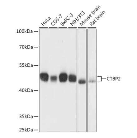 Western Blot - Anti-CTBP2 Antibody (A90156) - Antibodies.com