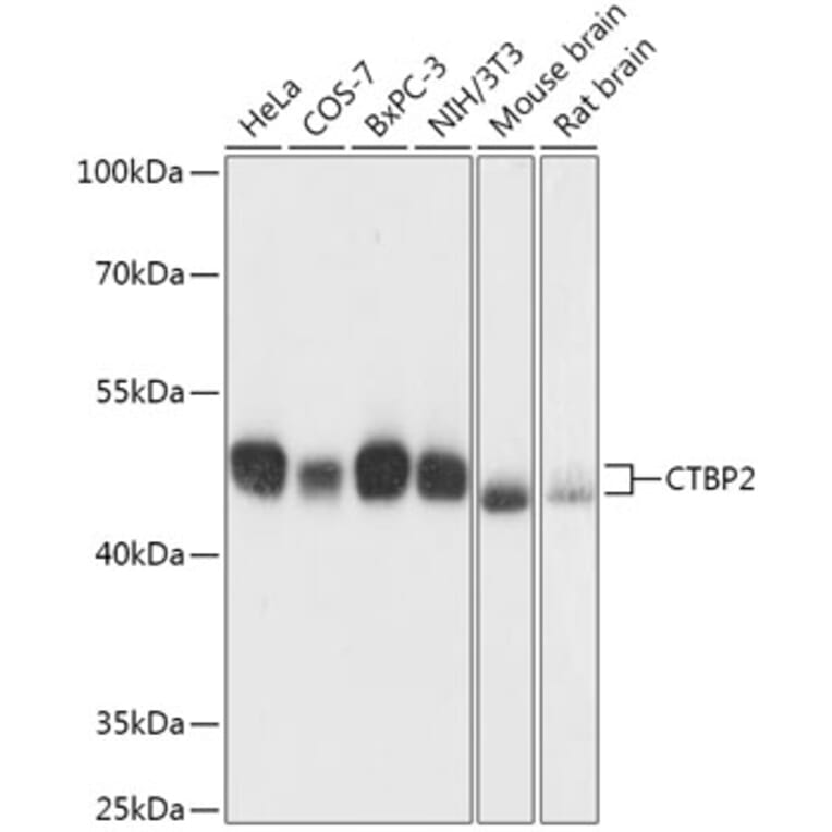 Western Blot - Anti-CTBP2 Antibody (A90156) - Antibodies.com