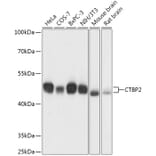 Western Blot - Anti-CTBP2 Antibody (A90156) - Antibodies.com