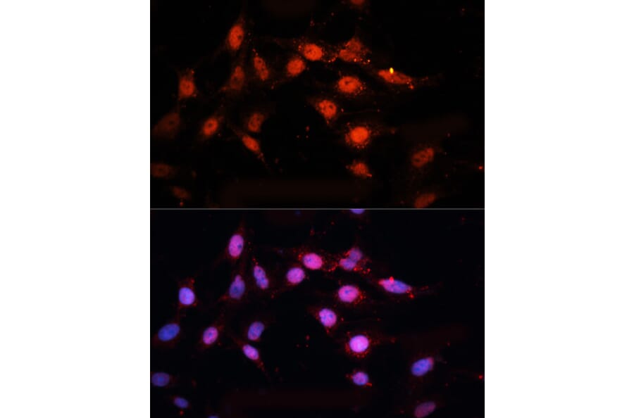Immunofluorescence - Anti-CTBP2 Antibody (A90156) - Antibodies.com