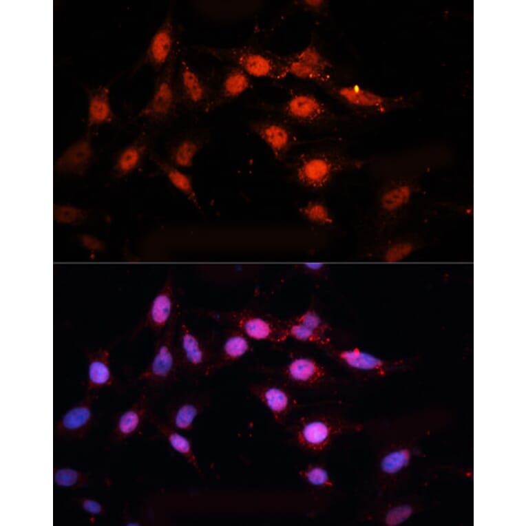 Immunofluorescence - Anti-CTBP2 Antibody (A90156) - Antibodies.com