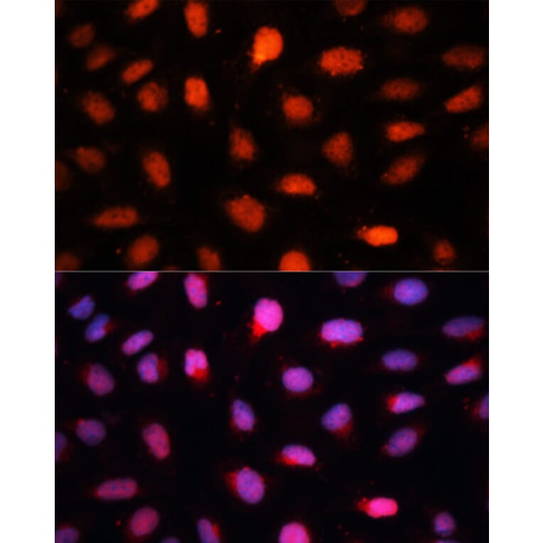 Immunofluorescence - Anti-CTBP2 Antibody (A90156) - Antibodies.com