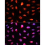 Immunofluorescence - Anti-CTBP2 Antibody (A90156) - Antibodies.com