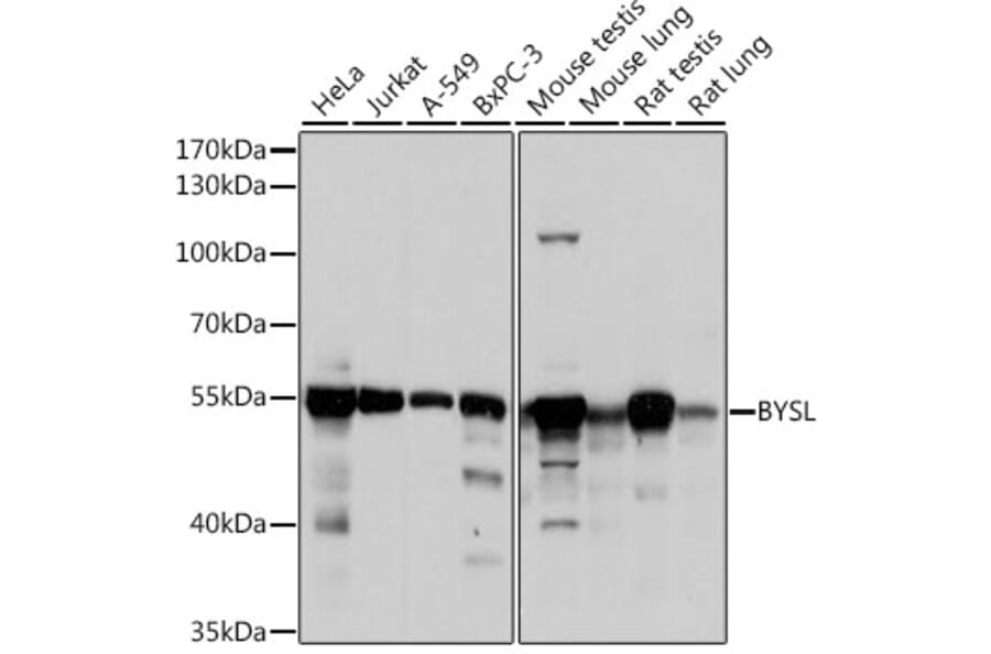 Western Blot - Anti-BYSL Antibody (A90157) - Antibodies.com