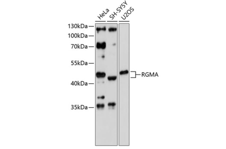Western Blot - Anti-RGMA Antibody (A4878) - Antibodies.com