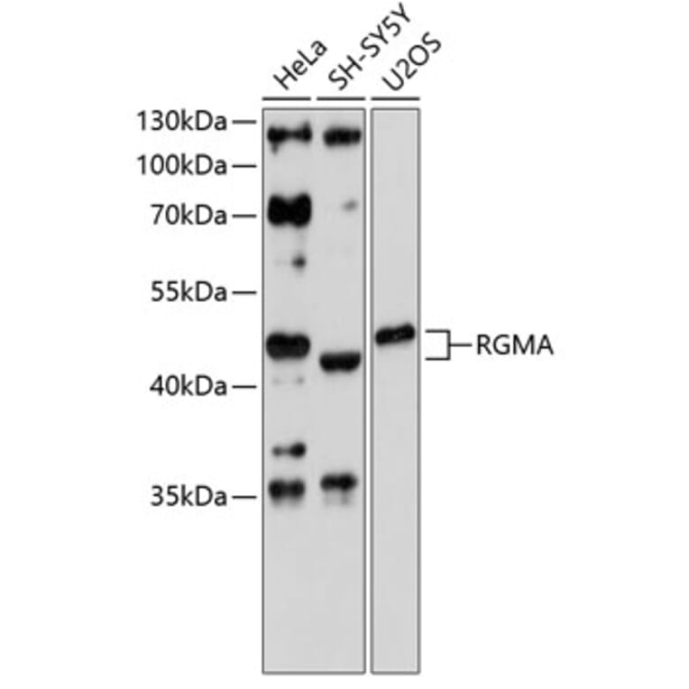 Western Blot - Anti-RGMA Antibody (A4878) - Antibodies.com