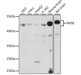 Western Blot - Anti-FNTB Antibody (A90159) - Antibodies.com