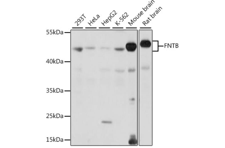 Western Blot - Anti-FNTB Antibody (A90159) - Antibodies.com
