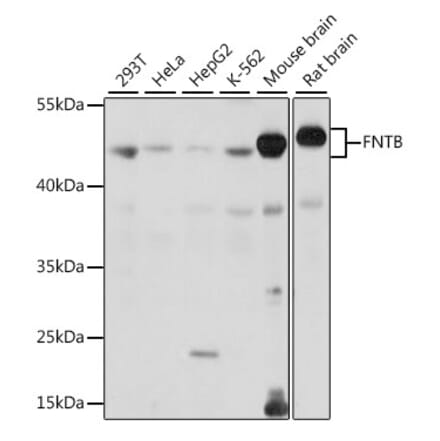 Western Blot - Anti-FNTB Antibody (A90159) - Antibodies.com