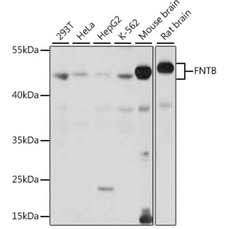 Western Blot - Anti-FNTB Antibody (A90159) - Antibodies.com