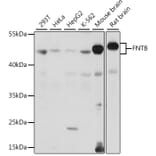 Western Blot - Anti-FNTB Antibody (A90159) - Antibodies.com