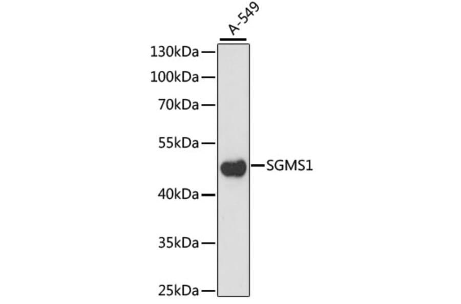 Western Blot - Anti-Sphingomyelin Synthase 1 Antibody (A90160) - Antibodies.com