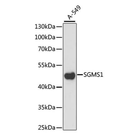 Western Blot - Anti-Sphingomyelin Synthase 1 Antibody (A90160) - Antibodies.com