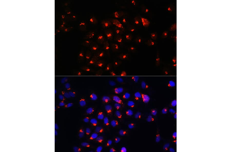 Immunofluorescence - Anti-Sphingomyelin Synthase 1 Antibody (A90160) - Antibodies.com
