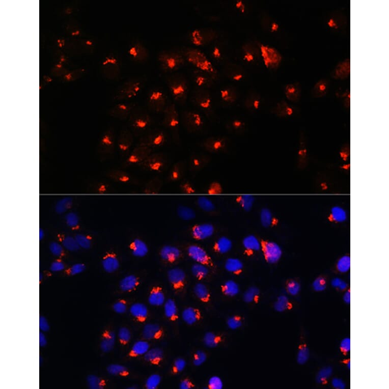 Immunofluorescence - Anti-Sphingomyelin Synthase 1 Antibody (A90160) - Antibodies.com