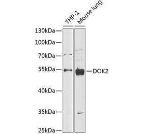 Western Blot - Anti-DOK2 Antibody (A90161) - Antibodies.com