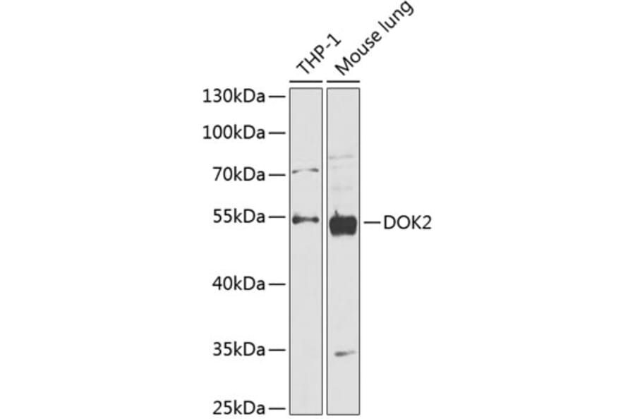 Western Blot - Anti-DOK2 Antibody (A90161) - Antibodies.com