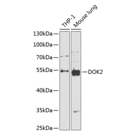 Western Blot - Anti-DOK2 Antibody (A90161) - Antibodies.com