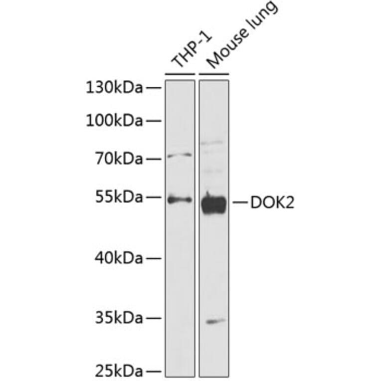 Western Blot - Anti-DOK2 Antibody (A90161) - Antibodies.com