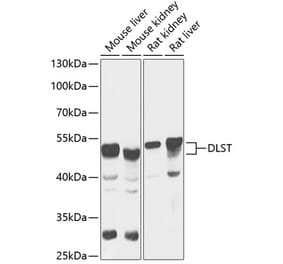 Western Blot - Anti-DLST Antibody (A90162) - Antibodies.com