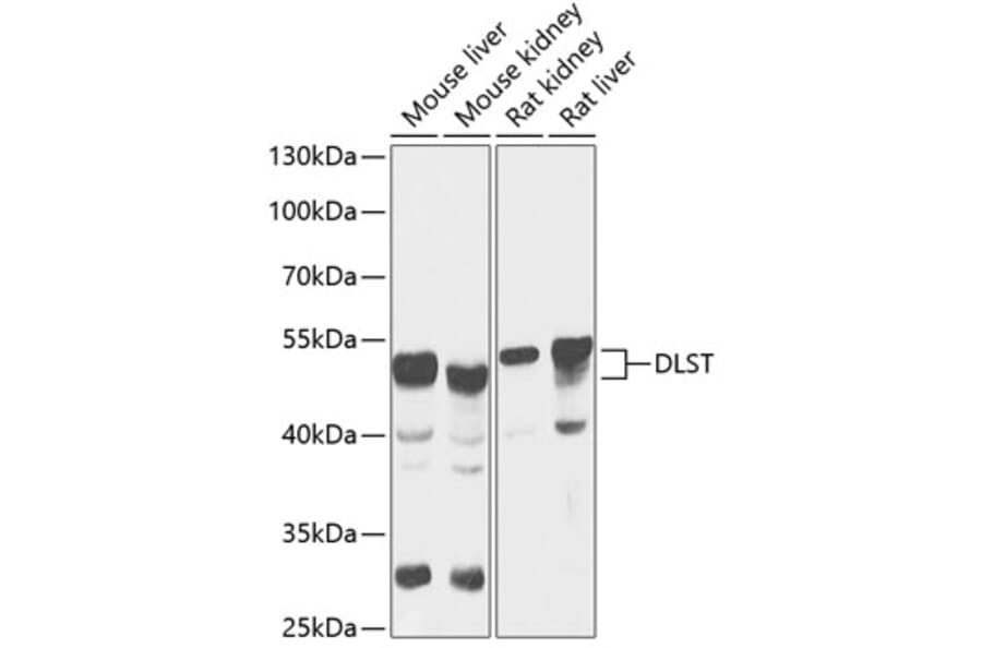 Western Blot - Anti-DLST Antibody (A90162) - Antibodies.com