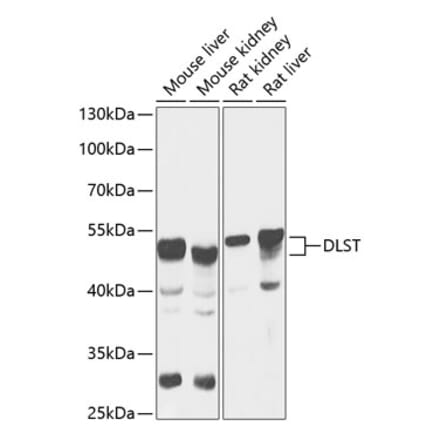 Western Blot - Anti-DLST Antibody (A90162) - Antibodies.com