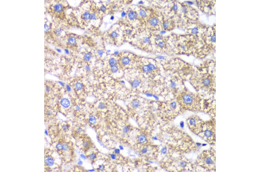 Immunohistochemistry - Anti-DLST Antibody (A90162) - Antibodies.com