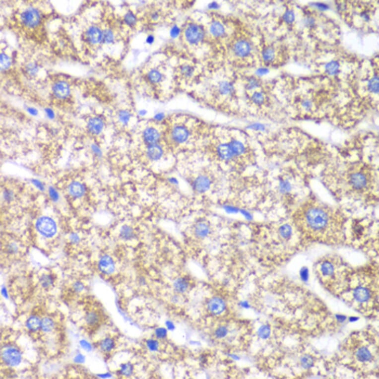 Immunohistochemistry - Anti-DLST Antibody (A90162) - Antibodies.com