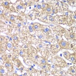 Immunohistochemistry - Anti-DLST Antibody (A90162) - Antibodies.com