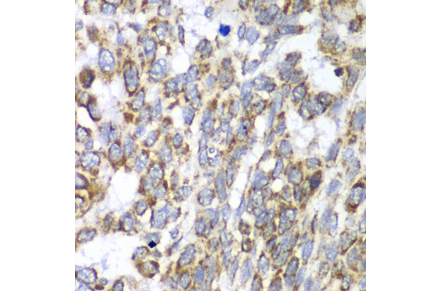 Immunohistochemistry - Anti-DLST Antibody (A90162) - Antibodies.com