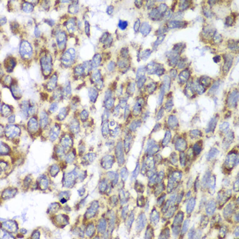 Immunohistochemistry - Anti-DLST Antibody (A90162) - Antibodies.com