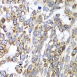 Immunohistochemistry - Anti-DLST Antibody (A90162) - Antibodies.com
