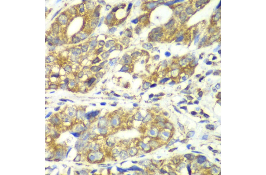 Immunohistochemistry - Anti-DLST Antibody (A90162) - Antibodies.com