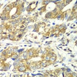 Immunohistochemistry - Anti-DLST Antibody (A90162) - Antibodies.com