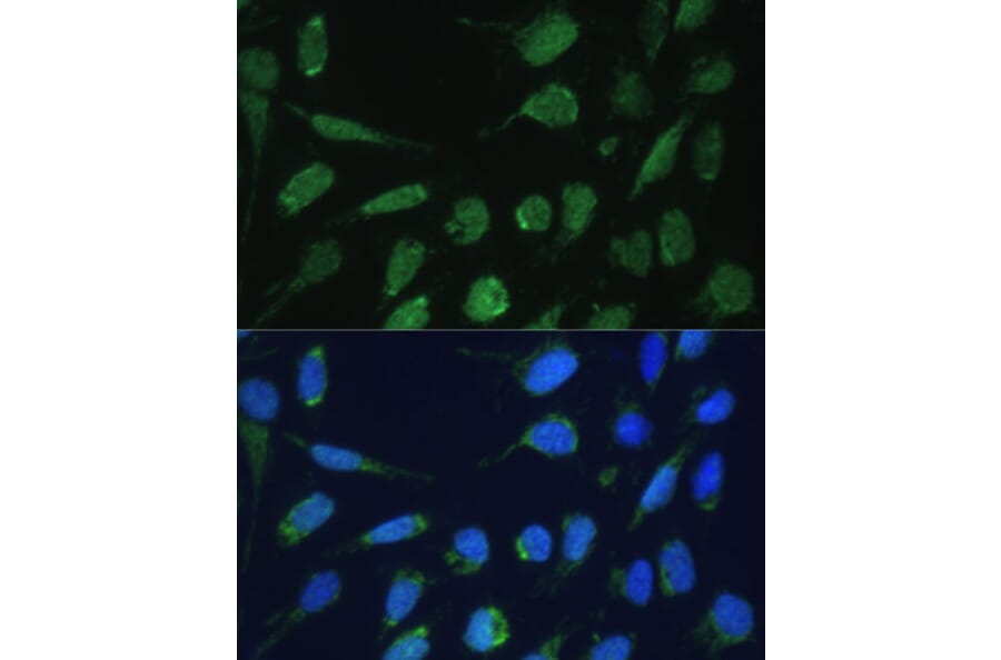 Immunofluorescence - Anti-DLST Antibody (A90162) - Antibodies.com