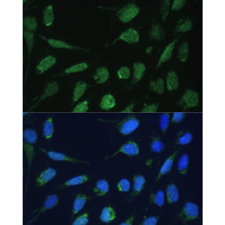 Immunofluorescence - Anti-DLST Antibody (A90162) - Antibodies.com