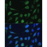 Immunofluorescence - Anti-DLST Antibody (A90162) - Antibodies.com