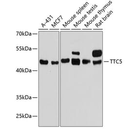 Western Blot - Anti-TTC5 Antibody (A90163) - Antibodies.com