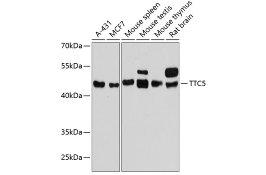 Western Blot - Anti-TTC5 Antibody (A90163) - Antibodies.com
