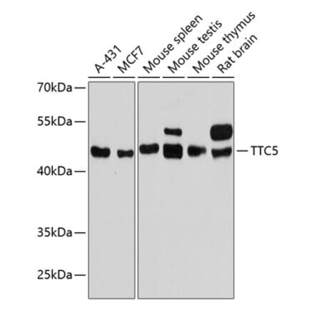 Western Blot - Anti-TTC5 Antibody (A90163) - Antibodies.com