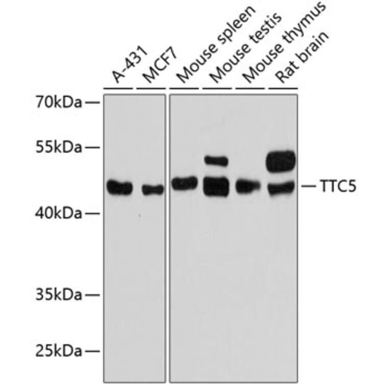 Western Blot - Anti-TTC5 Antibody (A90163) - Antibodies.com
