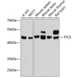 Western Blot - Anti-TTC5 Antibody (A90163) - Antibodies.com