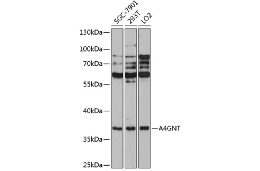 Western Blot - Anti-A4GNT Antibody (A90164) - Antibodies.com