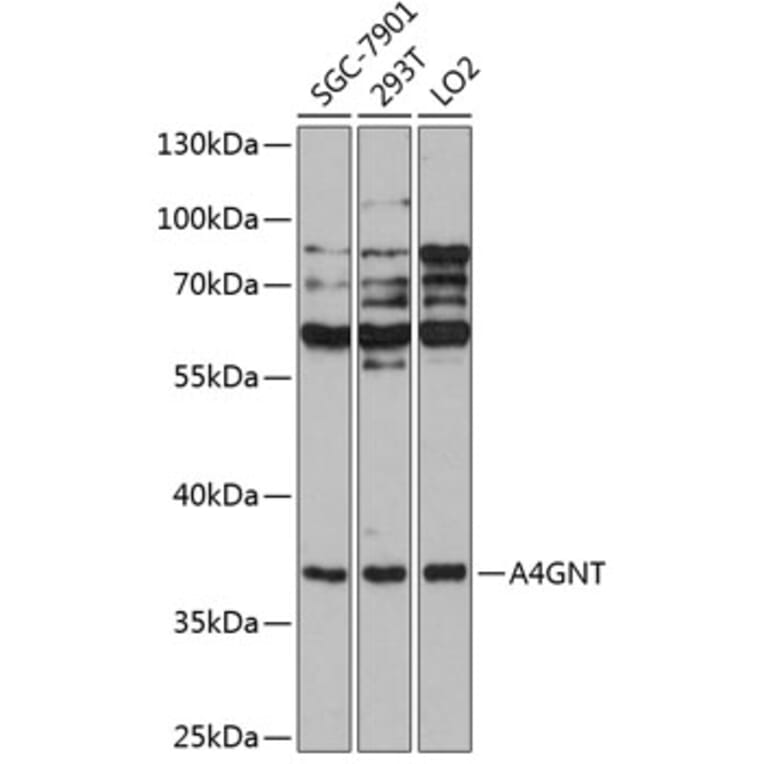 Western Blot - Anti-A4GNT Antibody (A90164) - Antibodies.com