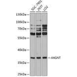 Western Blot - Anti-A4GNT Antibody (A90164) - Antibodies.com