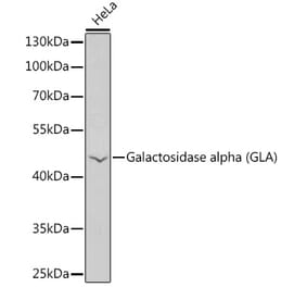 Western Blot - Anti-alpha Galactosidase A Antibody (A90165) - Antibodies.com
