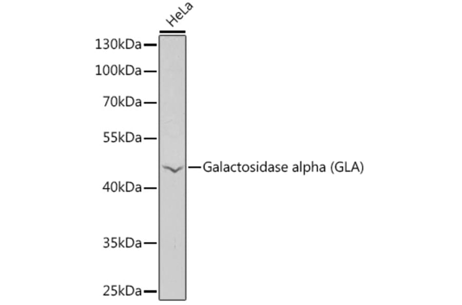Western Blot - Anti-alpha Galactosidase A Antibody (A90165) - Antibodies.com