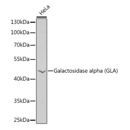 Western Blot - Anti-alpha Galactosidase A Antibody (A90165) - Antibodies.com