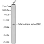 Western Blot - Anti-alpha Galactosidase A Antibody (A90165) - Antibodies.com